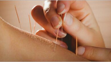 recall-healing-with-acupuncture-in-edmonton:-a-holistic-approach-to-wellness